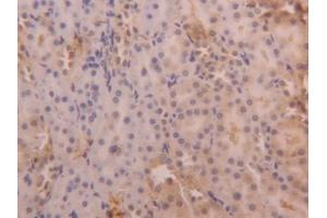 DAB staining on IHC-P; Samples: Rat Kidney Tissue (SERPINA6 抗体  (AA 173-344))