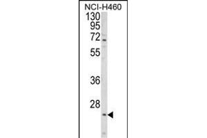 Western blot analysis of ALG14 Antibody (Center) (ABIN652850 and ABIN2842550) in NCI- cell line lysates (35 μg/lane). (ALG14 抗体  (AA 67-93))