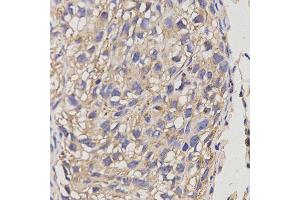 Immunohistochemistry (IHC) image for anti-ATP-Binding Cassette, Sub-Family A (ABC1), Member 6 (ABCA6) antibody (ABIN1870712) (ABCA6 抗体)