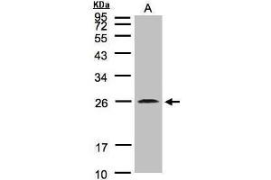 Western Blotting (WB) image for anti-Von Hippel-Lindau Tumor Suppressor, E3 Ubiquitin Protein Ligase (VHL) antibody (ABIN2854928)