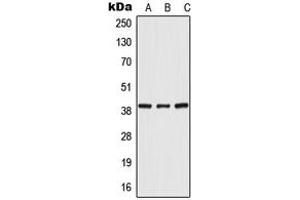Western blot analysis of POLR3F expression in HeLa (A), mouse liver (B), rat liver (C) whole cell lysates. (POLR3F 抗体  (Center))