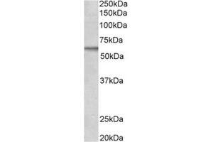 Antibody (2µg/ml) staining of MCF7 lysate (35µg protein in RIPA buffer). (ACVRL1 抗体  (C-Term))
