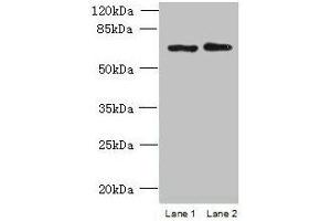 Western blot All lanes: TBC1D19 antibody at 9 μg/mL Lane 1: U251 whole cell lysate Lane 2: A375 whole cell lysate Secondary Goat polyclonal to rabbit IgG at 1/10000 dilution Predicted band size: 61, 53 kDa Observed band size: 61 kDa (TBC1D19 抗体  (AA 1-300))