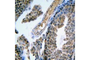 Immunohistochemical analysis of FSHR staining in human testis formalin fixed paraffin embedded tissue section. (FSHR 抗体  (Center))