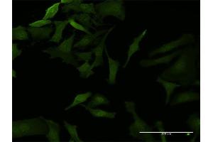 Immunofluorescence of monoclonal antibody to NFKBIB on HeLa cell. (NFKBIB 抗体  (AA 1-356))