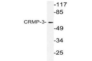 Western blot (WB) analysis of CRMP-3 antibody in extracts from HT-29 cells. (DPYSL4 抗体)