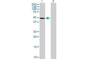 Western Blot analysis of SEMG1 expression in transfected 293T cell line by SEMG1 MaxPab polyclonal antibody. (SEMG1 抗体  (AA 1-402))