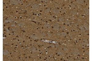 ABIN6277092 at 1/100 staining Rat brain tissue by IHC-P. (PPP4C 抗体  (C-Term))