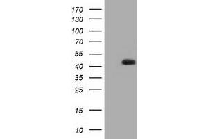 HEK293T cells were transfected with the pCMV6-ENTRY control (Left lane) or pCMV6-ENTRY HIBCH (Right lane) cDNA for 48 hrs and lysed. (HIBCH 抗体)