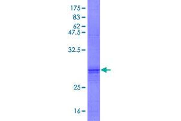 DENND11/KIAA1147 Protein (AA 12-43) (GST tag)