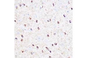 Immunohistochemistry of paraffin-embedded Mouse brain using CD47 antibody (ABIN6127604, ABIN6138199, ABIN6138201 and ABIN6223104) at dilution of 1:100 (40x lens). (CD47 抗体  (AA 20-140))
