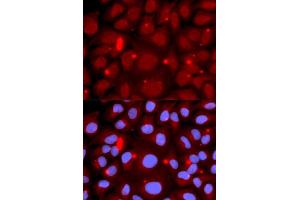 Immunofluorescence analysis of U2OS cells using PADI4 antibody (ABIN5970978).