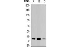 Western blot analysis of STAR expression in Jurkat (A), PC12 (B), mouse kidney (C) whole cell lysates. (STAR 抗体)
