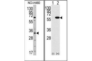 (LEFT)Western blot analysis of anti-YBX1 Antibody (N-term) in NCI-H460 cell line lysates (35ug/lane). (YBX1 抗体  (N-Term))