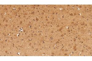 Immunohistochemistry (IHC) image for anti-Lectin, Galactoside-Binding, Soluble, 8 (LGALS8) (AA 1-317) antibody (ABIN7431593)