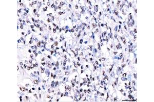 IHC analysis of CRTC3 using anti-CRTC3 antibody (ABIN7599779).