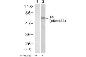 Image no. 1 for anti-Microtubule-Associated Protein tau (MAPT) (pSer422) antibody (ABIN319250) (MAPT 抗体  (pSer422))