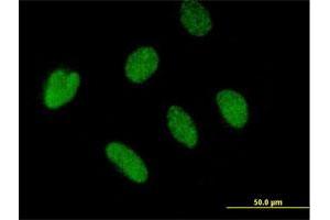 Immunofluorescence of purified MaxPab antibody to BTBD4 on HeLa cell. (ZBTB46 抗体  (AA 1-589))