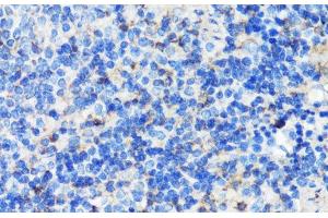 Immunohistochemistry of paraffin-embedded Mouse spleen using FLNA Polyclonal Antibody at dilution of 1:100 (40x lens). (Filamin A 抗体)