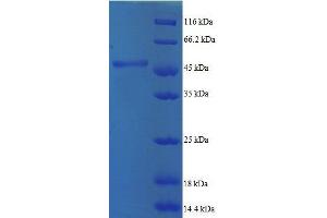 ADP-Ribosylation Factor 5 (ARF5) (AA 2-180), (full length) protein (GST tag) (ARF5 Protein (AA 2-180, full length) (GST tag))