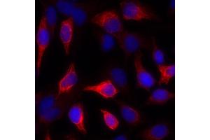 Immunofluorescence (IF) image for anti-Keratin 1 (KRT1) antibody (ABIN7449048) (Cytokeratin 1 抗体)