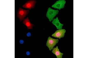 ABIN7095267 and ABIN7099324 staining Hela cells by IF/ICC. (LTC4S 抗体)