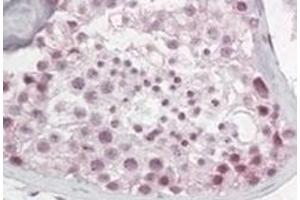 Image no. 2 for anti-Pescadillo Ribosomal Biogenesis Factor 1 (PES1) (N-Term) antibody (ABIN374331) (PES1 抗体  (N-Term))