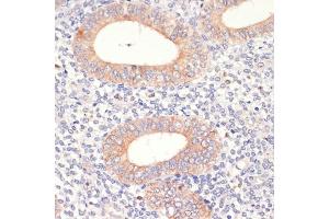 Immunohistochemistry (IHC) image for anti-3-Hydroxy-3-Methylglutaryl-CoA Reductase (HMGCR) (AA 629-888) antibody (ABIN3022294)