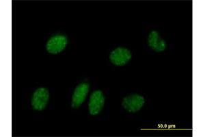 Immunofluorescence of purified MaxPab antibody to NPAS2 on HeLa cell. (NPAS2 抗体  (AA 1-824))