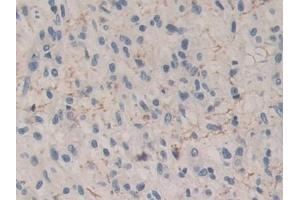 Immunohistochemistry (IHC) image for anti-Carboxypeptidase B1 (Tissue) (CPB1) (AA 111-417) antibody (ABIN7441961)