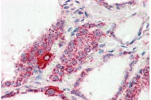 Human Thyroid (formalin-fixed, paraffin-embedded) stained with COX4I1 antibody ABIN461950 at 2. (COX IV 抗体  (AA 154-166))