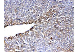IHC analysis of PON1 using anti-PON1 antibody . (PON1 抗体  (AA 30-274))