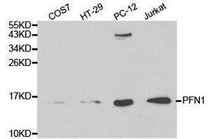 Western Blotting (WB) image for anti-Profilin 1 (PFN1) antibody (ABIN1874102) (PFN1 抗体)
