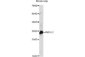 Western blot analysis of extracts of mouse lung, using PKD1L2 antibody. (PKD1L2 抗体)