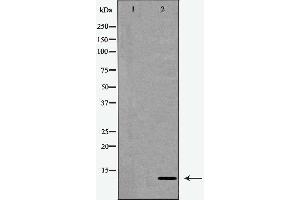 Western blot analysis of extracts from Jurkat cells, treated with serum (20%, 15mins), using CKS1 antibody. (CKS1 抗体  (N-Term))