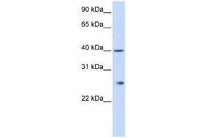 WB Suggested Anti-GSTK1 Antibody Titration: 0. (GSTK1 抗体  (N-Term))