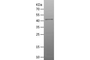 Western Blotting (WB) image for Lysosomal-Associated Membrane Protein 2 (LAMP2) (AA 34-231) protein (His-IF2DI Tag) (ABIN7123813)