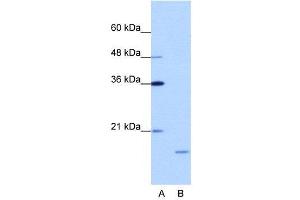 WB Suggested Anti-ISG20  Antibody Titration: 1. (ISG20 抗体  (N-Term))