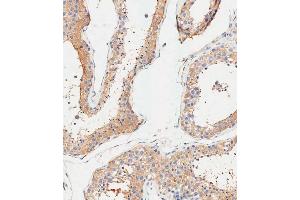 Immunohistochemical analysis of paraffin-embedded Human testis tissue using (ABIN1945086 and ABIN2838551) performed on the Leica® BOND RXm. (ALDH1A1 抗体  (AA 306-339))