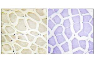 Immunohistochemistry (IHC) image for anti-Collagen, Type X, alpha 1 (COL10A1) (C-Term) antibody (ABIN1850314)
