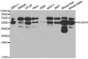 Western blot analysis of extracts of various cell lines, using SCARB1 antibody. (SCARB1 抗体  (AA 1-100))