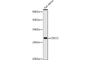 Western blot analysis of extracts of Rat uterus, using CD151 antibody (ABIN3023660, ABIN3023661, ABIN3023662, ABIN1679069 and ABIN6219074) at 1:1000 dilution. (CD151 抗体  (AA 113-221))