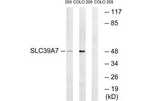 Western Blotting (WB) image for anti-Solute Carrier Family 39 (Zinc Transporter), Member 7 (SLC39A7) (Internal Region) antibody (ABIN1852426) (SLC39A7 抗体  (Internal Region))