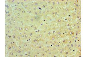 Immunohistochemistry of paraffin-embedded human liver tissue using ABIN7172247 at dilution of 1:100 (TRAF6 抗体  (AA 1-522))