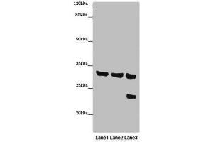 Western blot All lanes: SLC25A10 antibody at 16 μg/mL Lane 1: Mouse liver tissue Lane 2: Mouse kidney tissue Lane 3: HepG2 whole cell lysate Secondary Goat polyclonal to rabbit IgG at 1/10000 dilution Predicted band size: 32, 33 kDa Observed band size: 32, 24 kDa (Slc25a1 抗体  (AA 124-162))