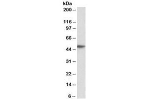 Western blot testing of human peripheral blood lymphocyte lysate with FCER1A antibody at 0. (Fc epsilon RI/FCER1A 抗体)