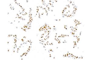 Immunocytochemistry (ICC) image for anti-Sp1 Transcription Factor (SP1) (AA 250-300) antibody (ABIN7795788) (Recombinant SP1 抗体  (AA 250-300))