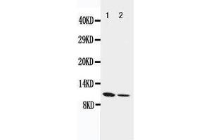 Anti-Resistin antibody, Western blotting Lane 1: Recombinant Mouse Resistin Protein 10ng Lane 2: Recombinant Mouse Resistin Protein 5ng (Resistin 抗体  (C-Term))