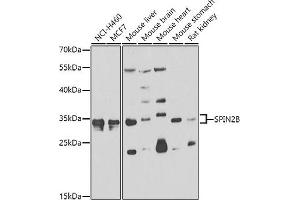 Western blot analysis of extracts of various cell lines, using SPIN2B antibody  at 1:1000 dilution. (Spindlin 2B 抗体  (AA 1-258))
