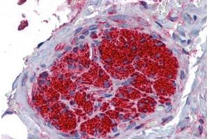 Human Peripheral Nerve: Formalin-Fixed, Paraffin-Embedded (FFPE) (SGCB 抗体  (AA 87-197))